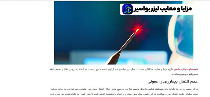 مزیت لیزر هموروئید